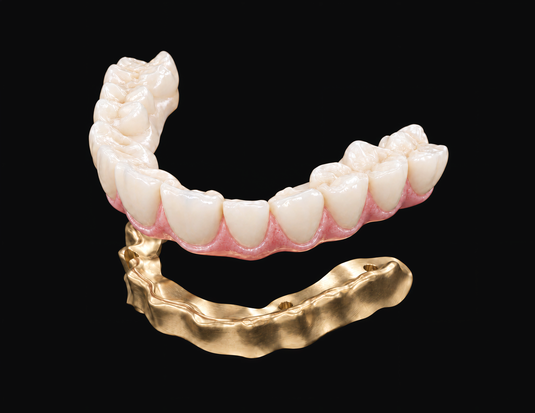 Zirkonová konstrukce s gingivou nad zlatě anodizovaným titanovým třmenem